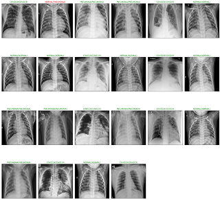 COVID-19 X-ray detection project preview